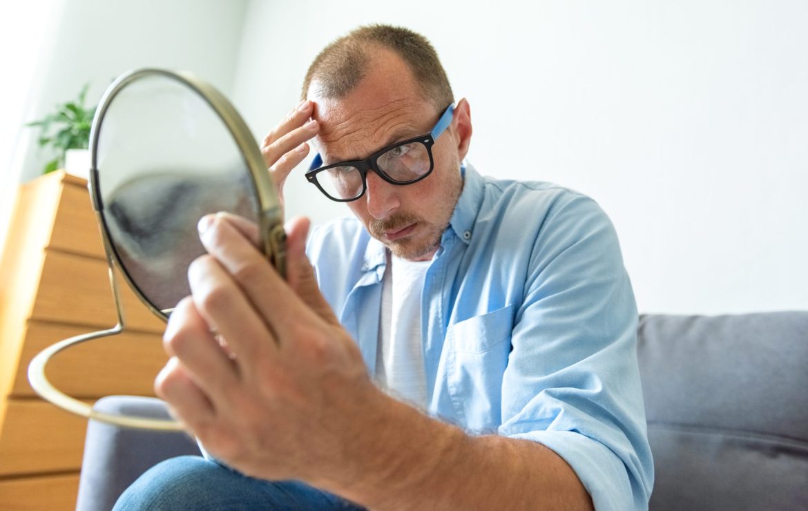 NazlıHairTransplant: Bahçelievler”e Saç, Kaş ve Sakal Ekimi